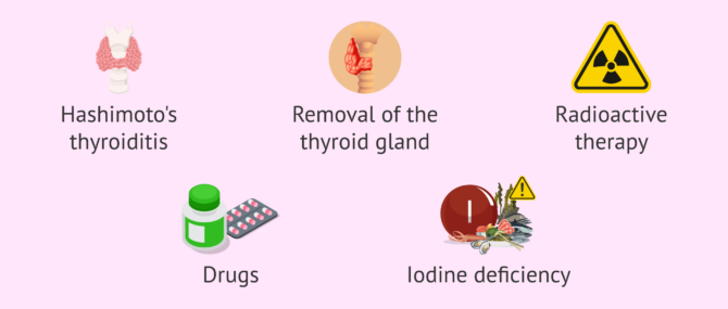 Imagen: Causes of hypothyroidism