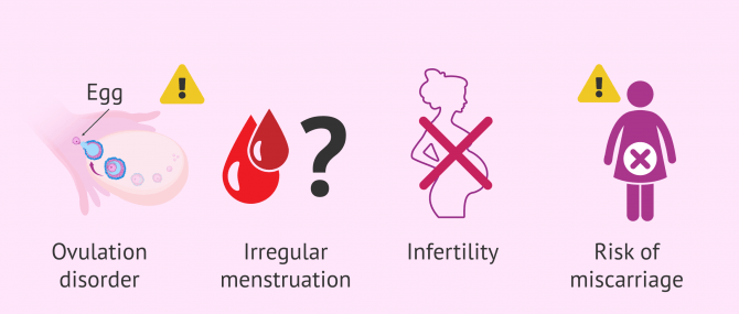 Imagen: Consequences on female fertility due to thyroid problems