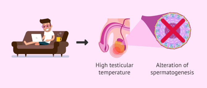 Imagen: High scrotal temperature and sperm production