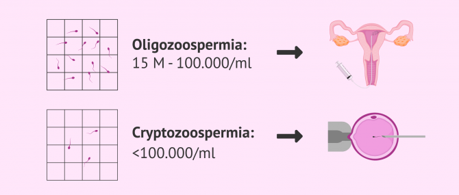 Imagen: How to treat low sperm count in men