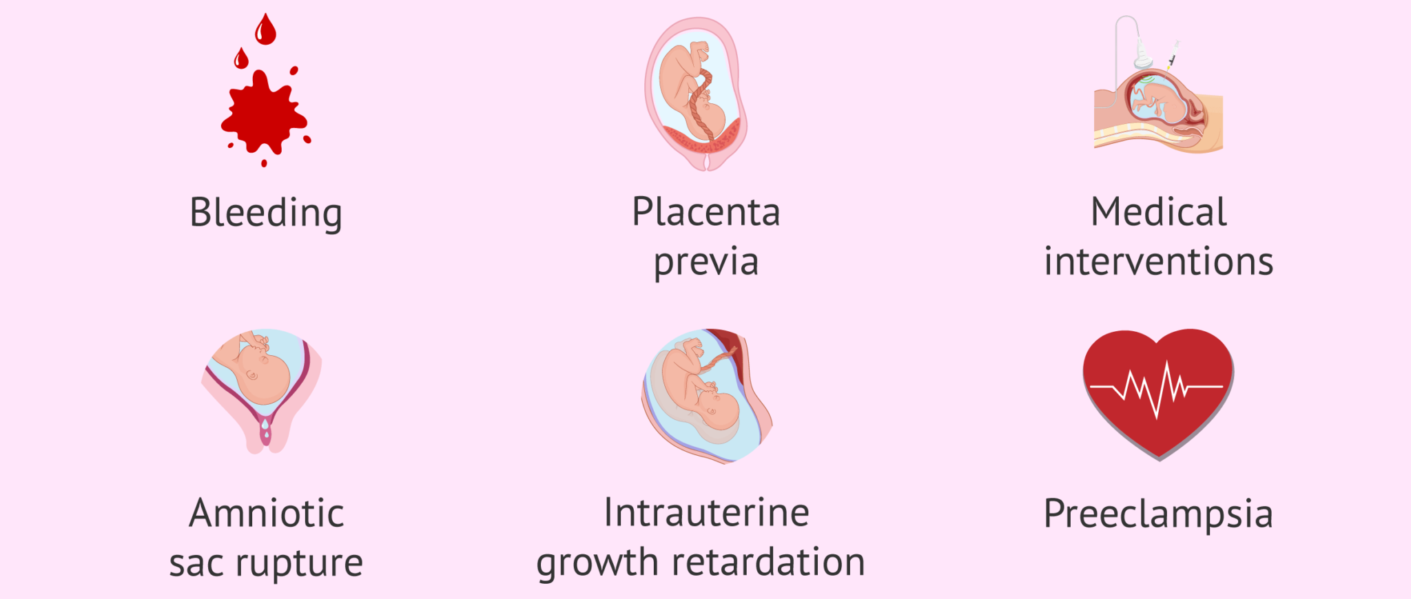 when-can-absolute-rest-be-indicated-in-pregnancy