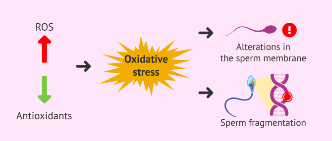 Imagen: Oxidative stress and recurrent miscarriage