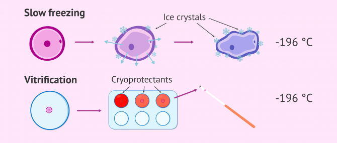 Imagen: Slow freezing and vitrification of eggs