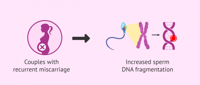 Imagen: Sperm DNA fragmentation and recurrent miscarriage