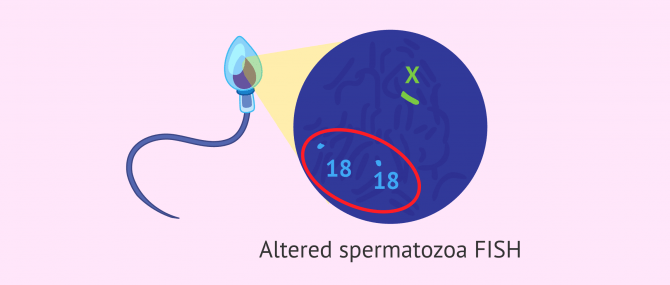 Imagen: FISH of altered spermatozoa