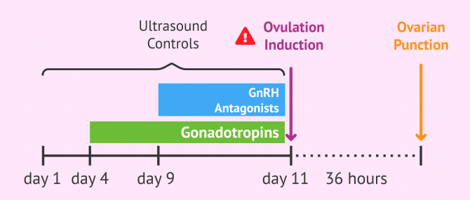 Imagen: Problems in the hormonal administration in ovarian stimulation