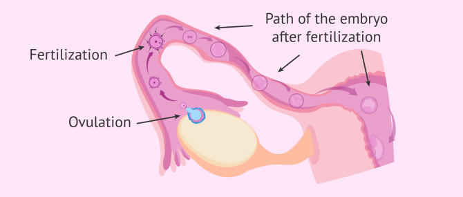 Imagen: Importance of the Fallopian Tubes