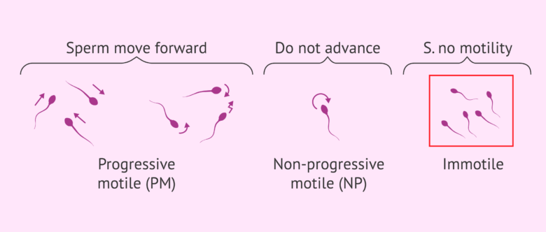 Motility Range Chart