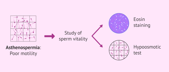 Imagen: Tests to distinguish between live and dead immotile spermatozoa