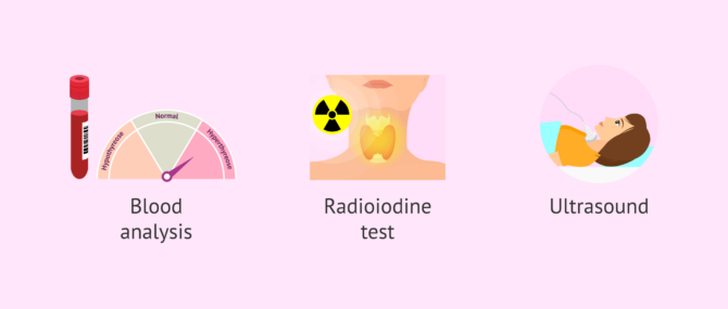 tests-for-hyperthyroidism