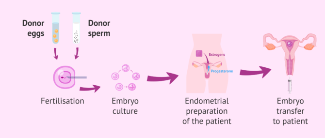 Imagen: Step-by-step of IVF with double donation for single women