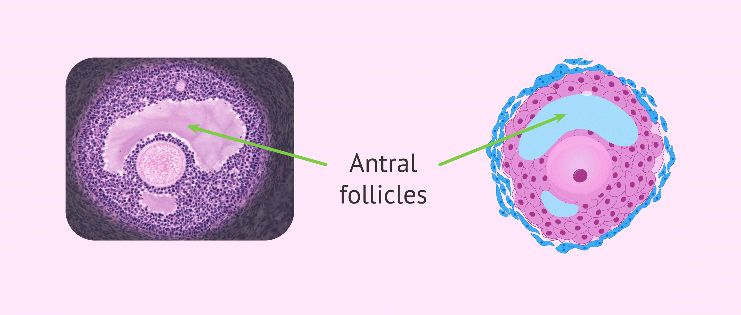 Imagen: Definition of antral follicle