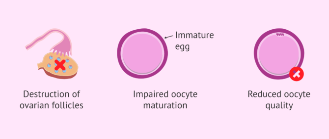 Imagen: Effects of chemotherapy on female fertility