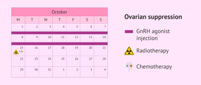 Imagen: Protocol for ovarian suppression