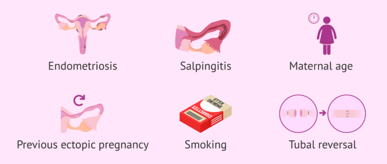 Risk factors for pregnancy outside the womb