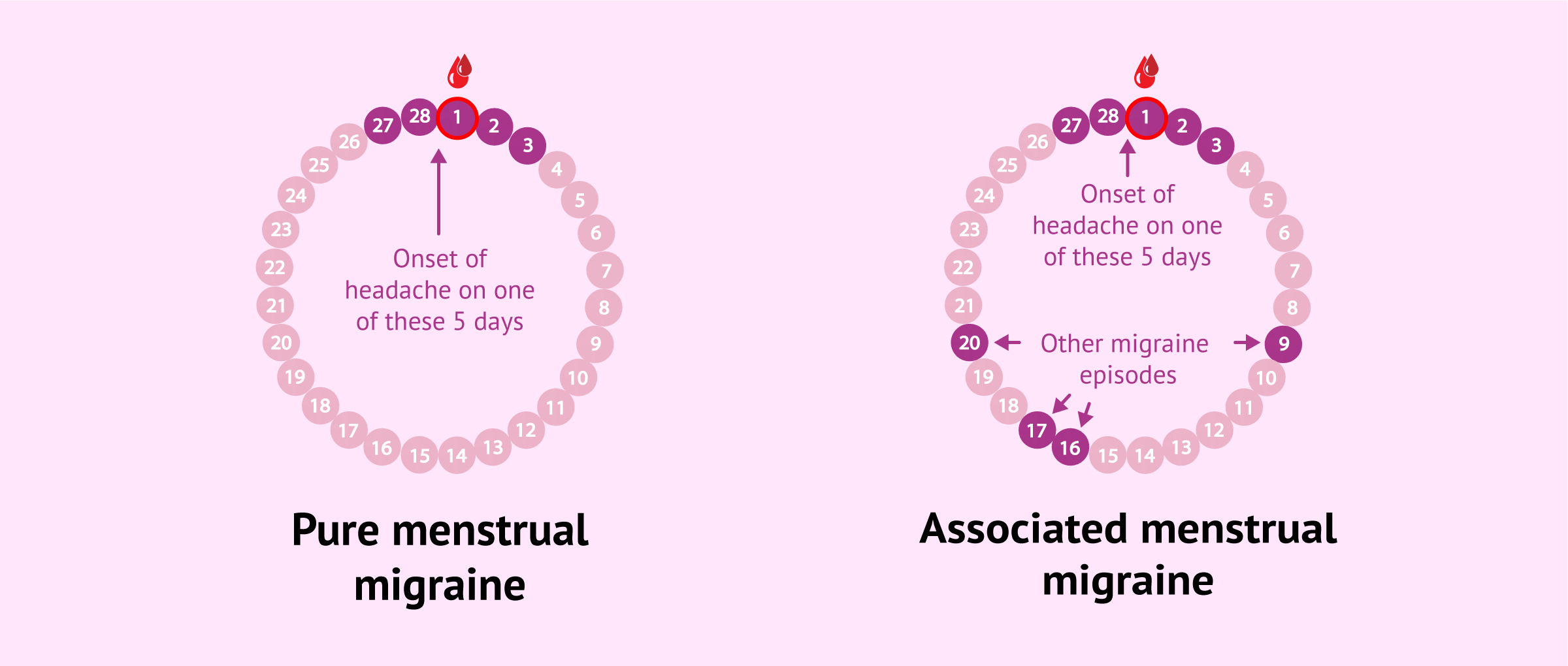 Imagen: Classification of menstrual migraines