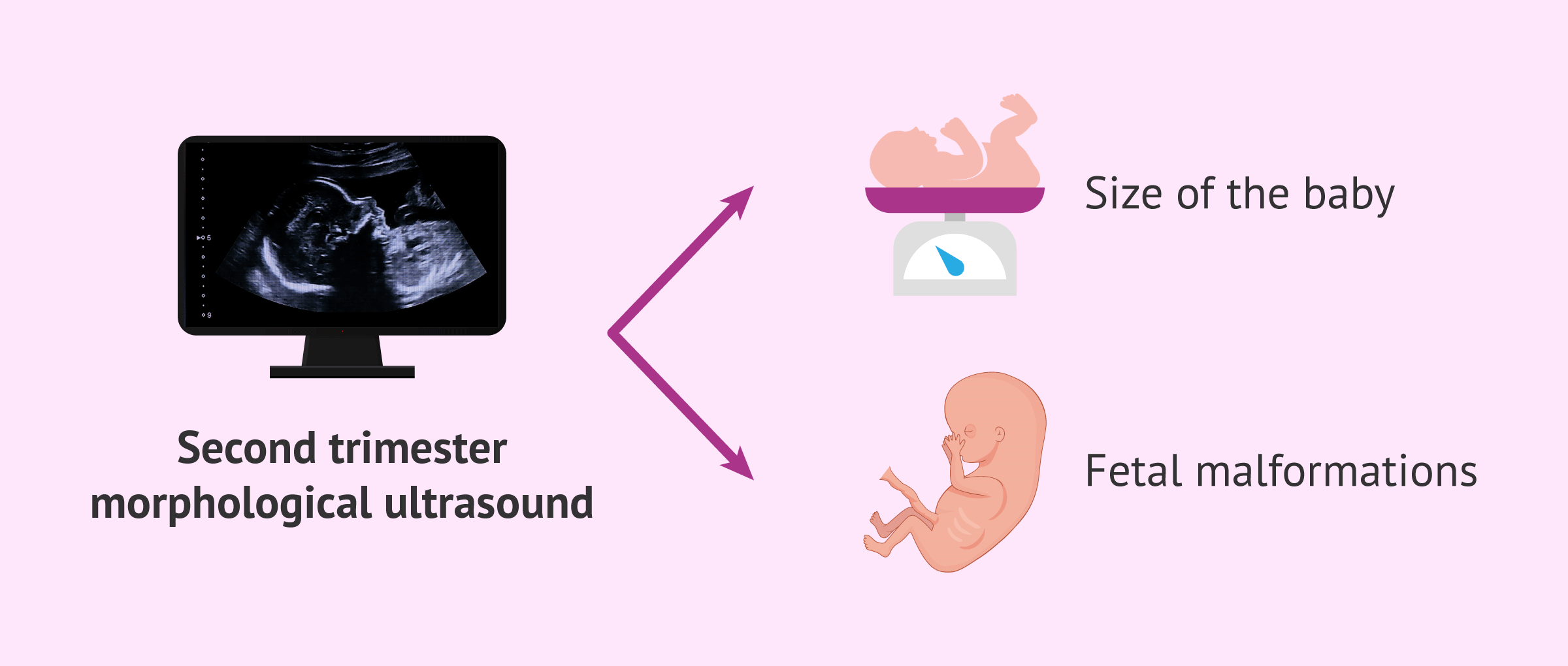 Imagen: Morphologic ultrasound in the 19th week of pregnancy