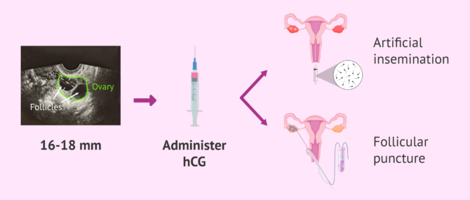 Imagen: How is ovulation induced