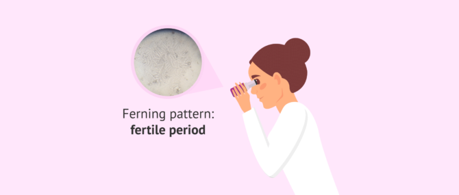 Imagen: How to interpret the results of a saliva ferning test.