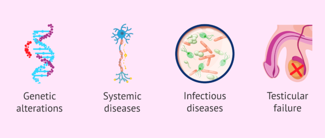 Imagen: Possible causes of Hypergonadotropic Hypogonadism