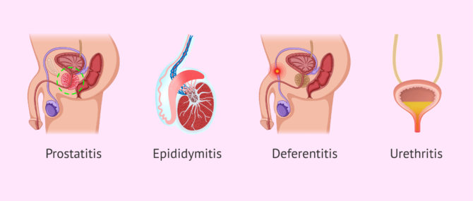 Imagen: What are semen infections?