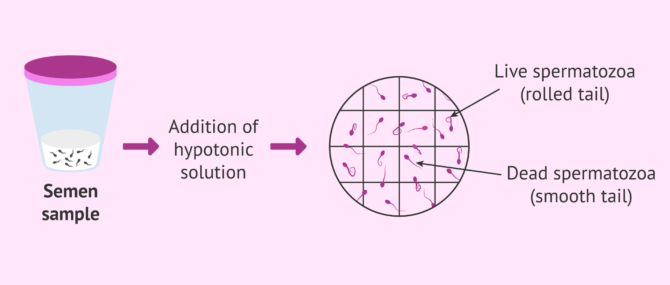 Imagen: Hypoosmotic test for male fertility testing