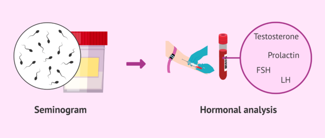 Imagen: Male hormonal analysis