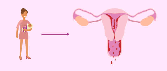 Imagen: Period after childbirth