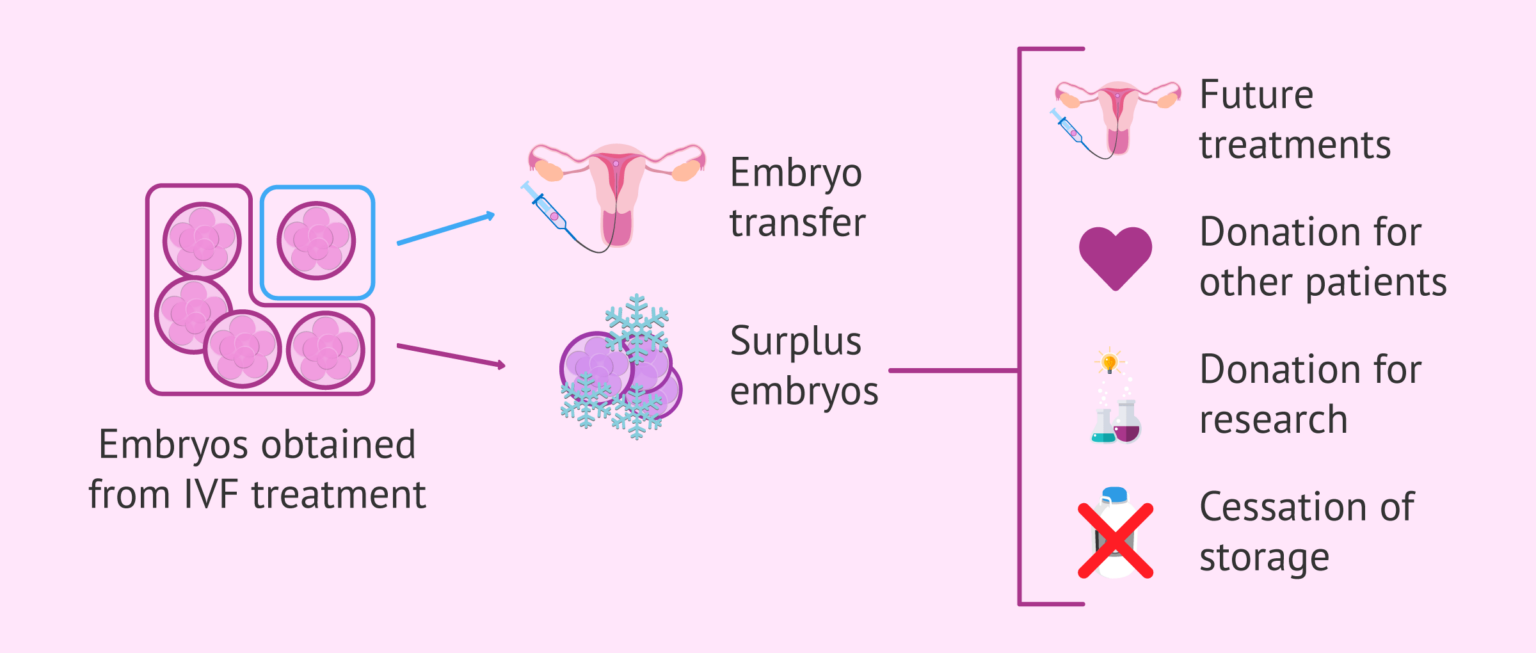 IVF using donor sperm: the process, costs and its success rates