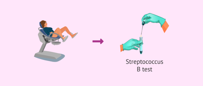 Imagen: The group B Streptococcus test in pregnancy