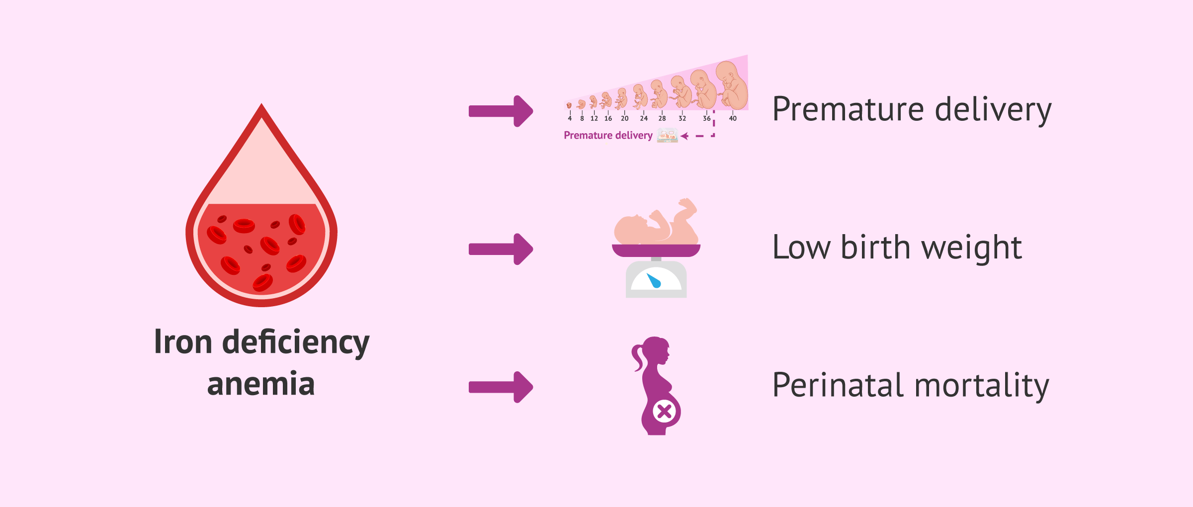 Imagen: Risks of anemia during pregnancy