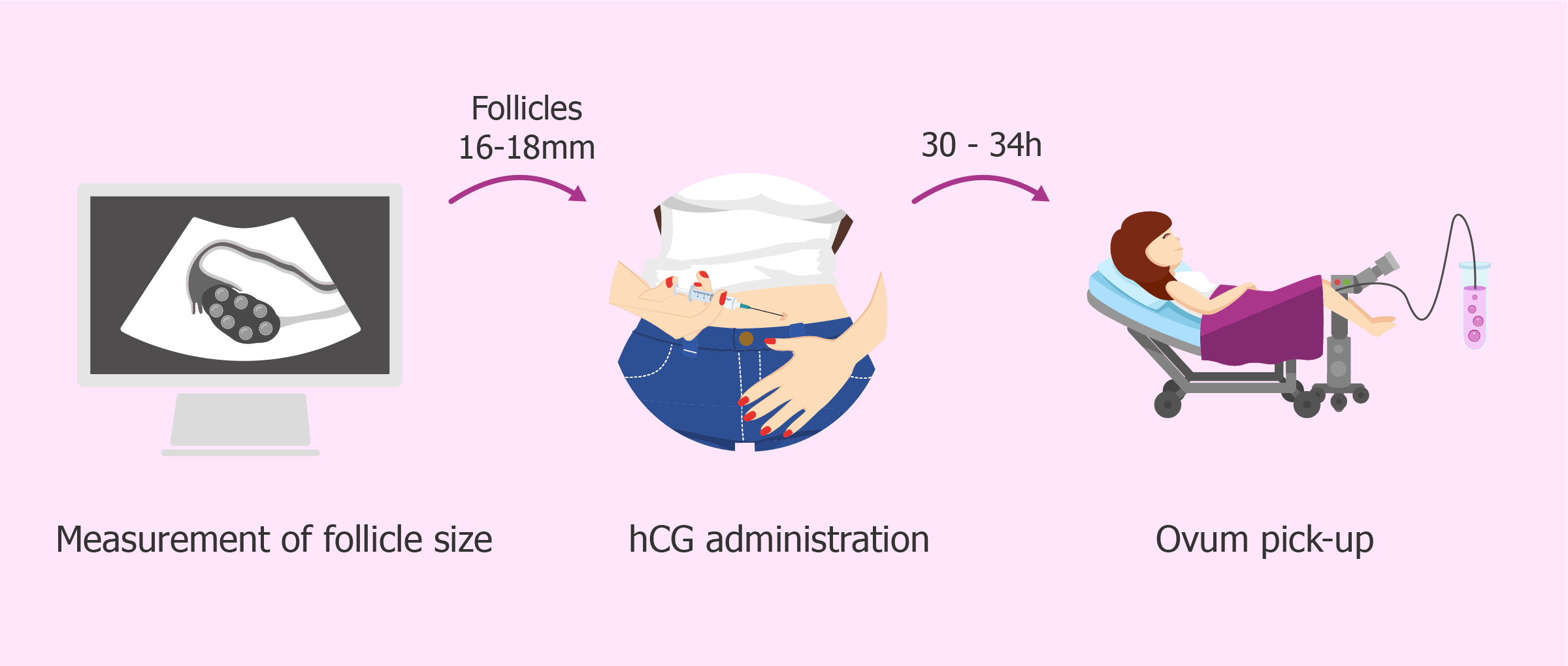 retrieved ivf eggs 8 timeline Ovulation and retrieval IVF tracking egg cycle