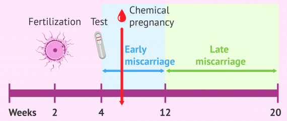 can-a-negative-blood-type-cause-miscarriage-stashokentertainment