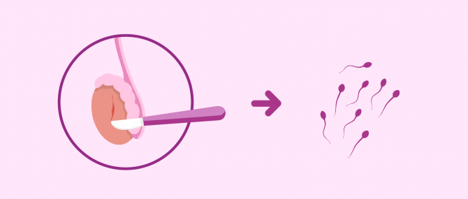 What Is A Testicular Biopsy Purpose And Procedure