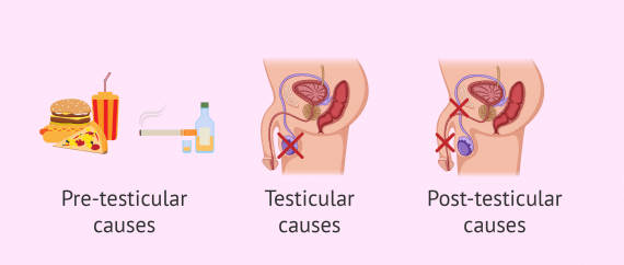 cryptozoospermia – definition, causes, treatment & pregnancy