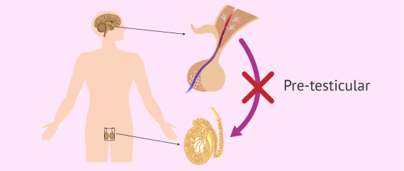 what are the causes of azoospermia?